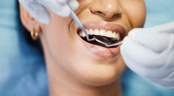 Best Emergency Wisdom Teeth Removal in Salem, OH